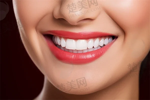 成都冷光美白牙齿美容整形排名医院排行榜公布!