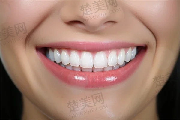 成都冷光美白牙齿医院排名榜盘点前二科室!