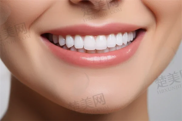 成都全口牙正规口腔医院排行+费用预览!