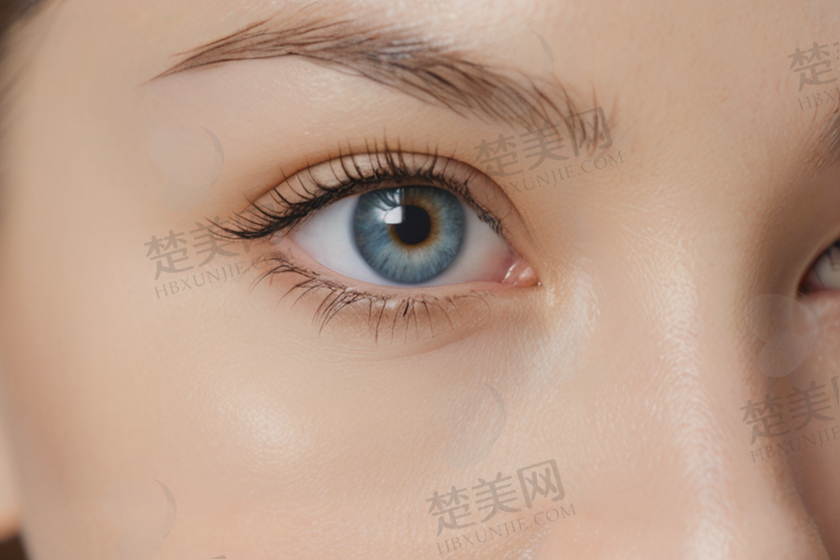 红眼病有什么样的诊断方法
