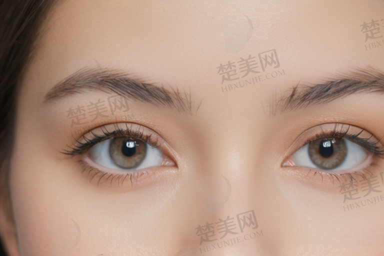 红眼病是怎么传染的呢