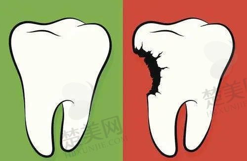 南京茀莱堡口腔种植牙、牙齿矫正、儿牙等项目贵吗?点击了解价格表