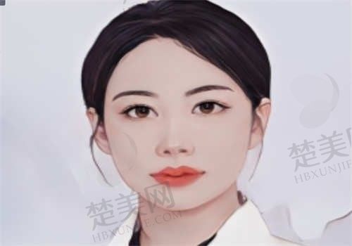 杨菲菲