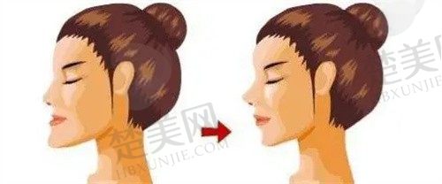 山海何晋龙医生怎么样？磨骨做得好，打造自然精致脸型