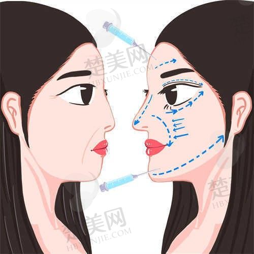 长沙贝美整形美容门诊隆鼻假体取出49250元起，重塑自信容颜