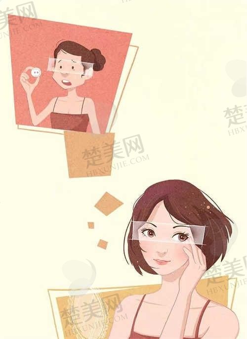北京品质丽珍医疗美容诊所双眼皮修复13000元起，服务优质