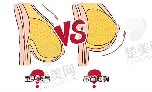 包头舒华医疗美容整形医院无痕微创隆胸手术16700元起，美丽蜕变