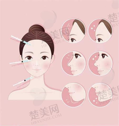 贵阳奥拉克医疗美容诊所埋线双眼皮11000元起，超值优惠活动