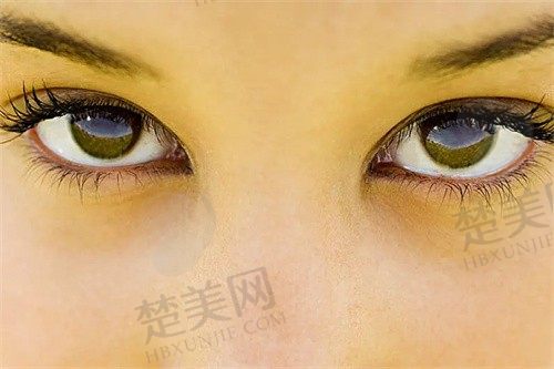 泉州华厦眼科医院是私立的吗？是私立连锁眼科医院，价格、口碑全面解析