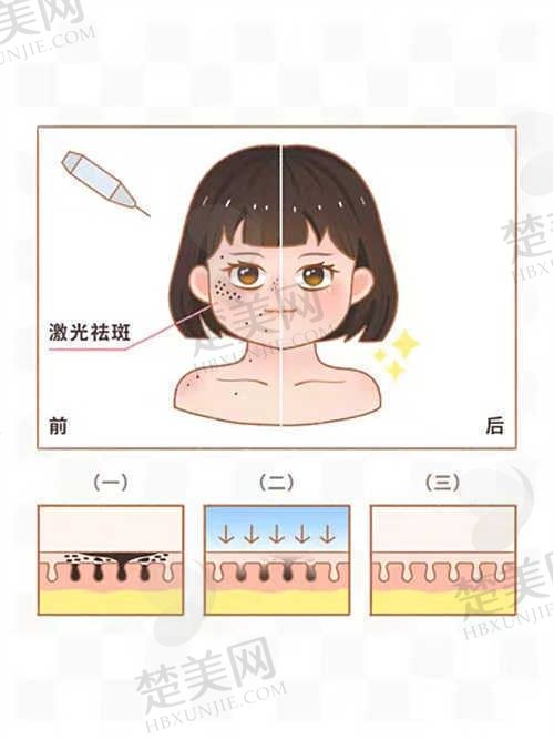 海口叶子妃医疗整形美容怎么样，值得信赖的医美选择，口碑佳，服务好！