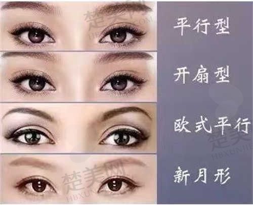 德宏瑞丽吴氏嘉美整形医院经典双眼皮手术22000元起，价格表详解