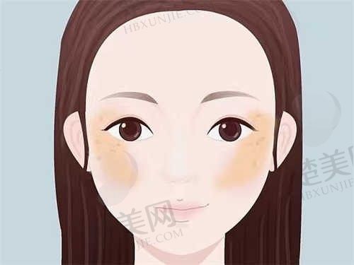 济南鹏爱美容整形硅胶隆鼻30000元起，权威骨干医生，价格透明