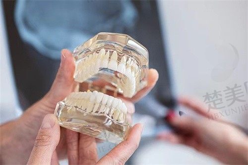 沈阳盛大口腔医院怎么样?种植牙技术及价格详解,口碑好,值得信赖!
