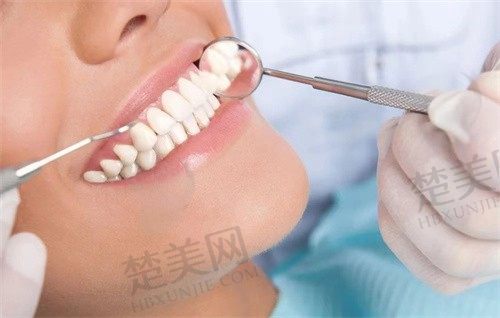长春国健口腔医院地址在哪?种植牙费用及口碑深度解析,价格合理口碑好