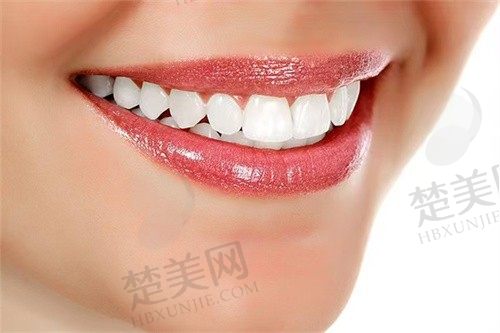 郑州白皮书口腔医院收费高吗?种植牙价格透明公开,性价比高值得推荐!