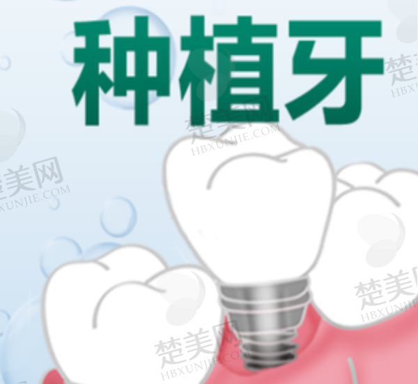 2025深圳种植牙排名前十名医院分享,种牙技术好价格又便宜