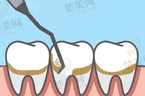义乌傅氏口腔医院好不好?30年老牌牙科真实测评,种牙/矫正口碑炸裂!