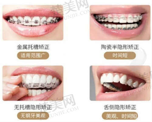 浙江绍兴柯桥德维口腔医院