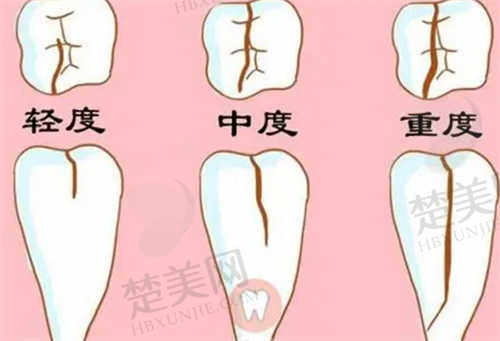 合肥中诺口腔医院种植牙怎么样