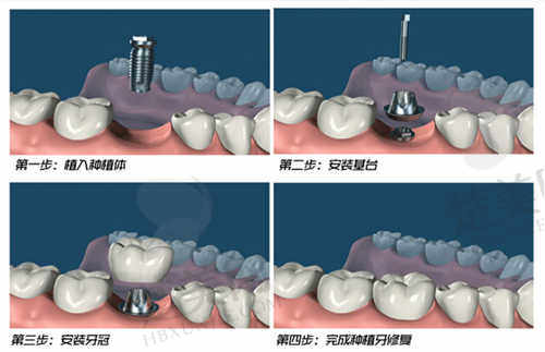 永州牙闪闪口腔医院患者评价