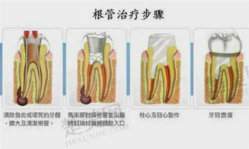 东莞牙德美口腔医院部分项目价格