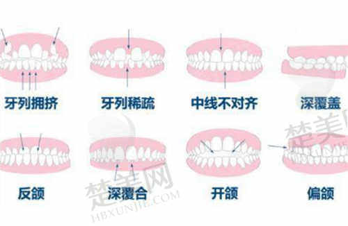 上海摩尔口腔医院热门项目价格