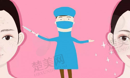 杭州艺星医疗美容医院徐利刚医生介绍：