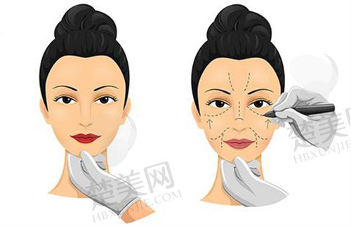 杭州艺星医疗美容医院真实实例和用户评价