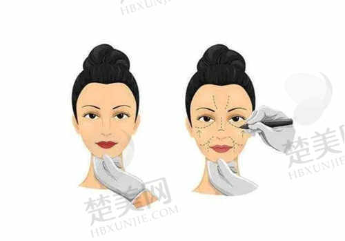 昆明佩蒂医疗美容诊所患者评价