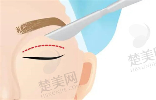 杭州童颜医疗美容医院眼综合多少钱