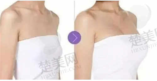 泉州义华医疗美容诊所