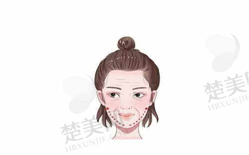 中山倾妍医疗美容诊所患者评价