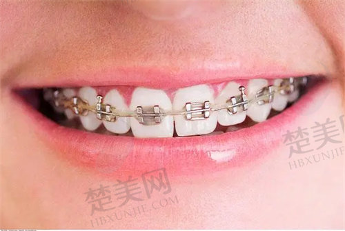 郑州白皮书口腔医院收费高吗