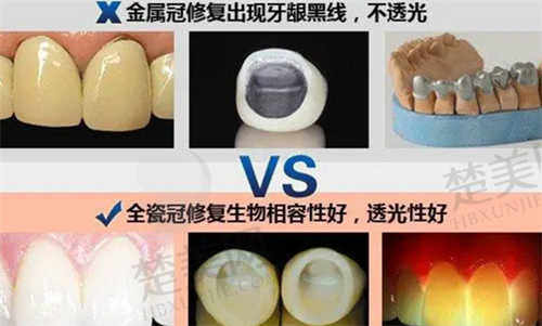 昆明博众口腔诊所特色项目及技术