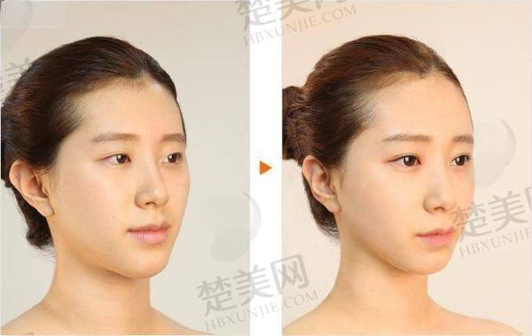 广州军美王世虎小V脸怎么样