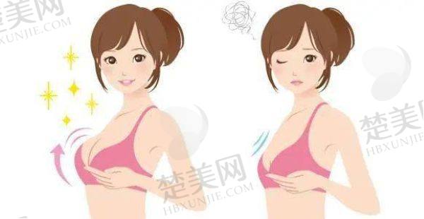上海正规的隆胸医院