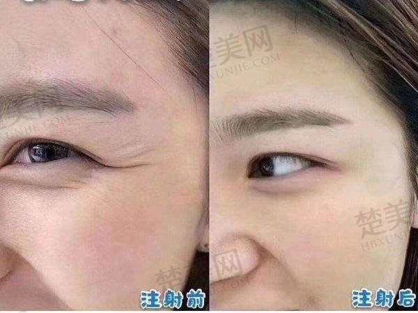 上海蔡跃波医生注射技术优势