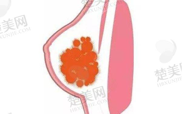 国内较好的清奥手术医生是谁