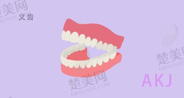 北京吸附性义齿医院排名前十
