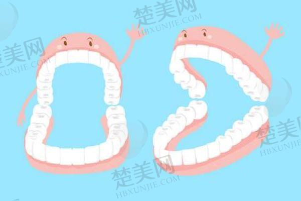北京吸附性义齿多少钱