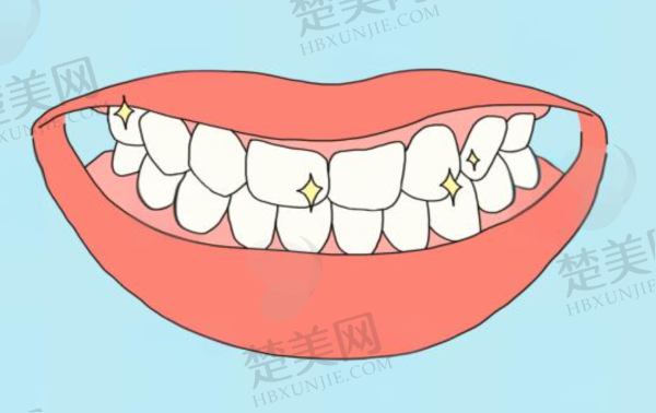 北京吸附性义齿哪家医院可做