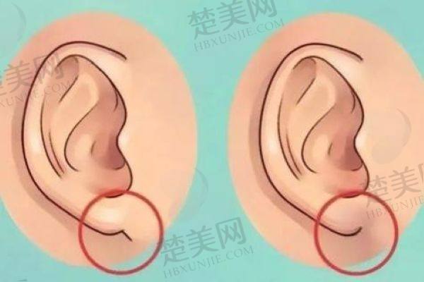 国内小耳畸形医生排名前十