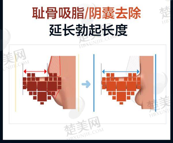 重庆星荣整形外科医院怎么样