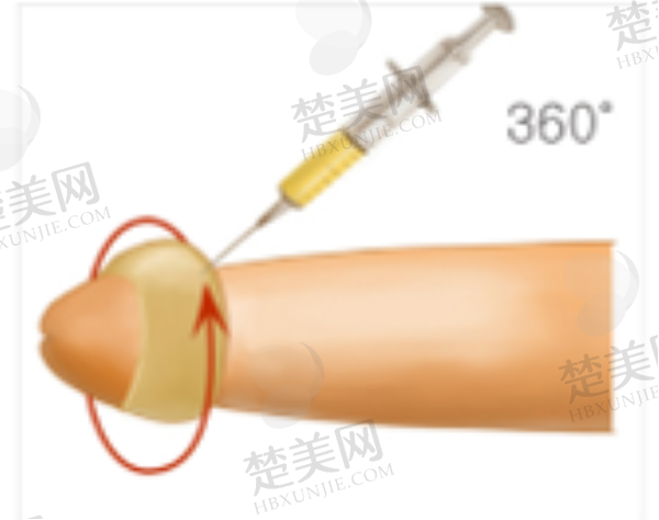 重庆星荣整形外科医院价格表
