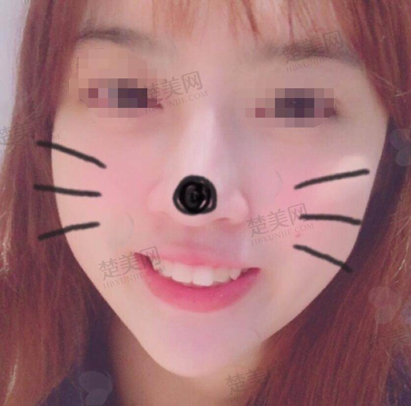 非常新口腔矫正案例及价格表公布！四川华西医院口腔科专家实力如何？