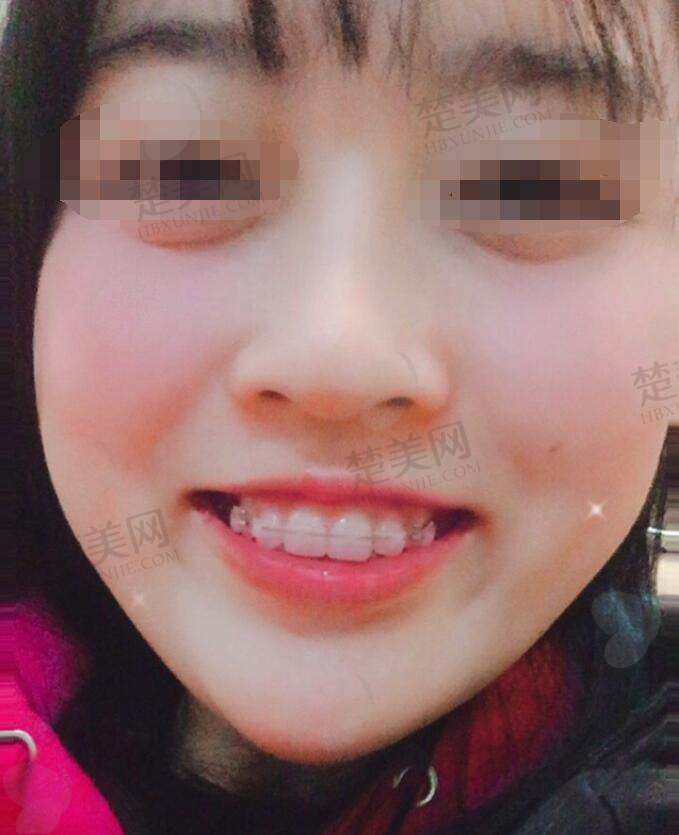 非常新口腔矫正案例及价格表公布！四川华西医院口腔科专家实力如何？