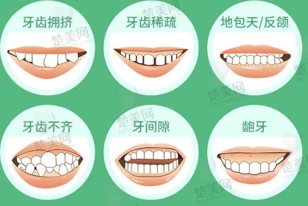 牙齿矫正.