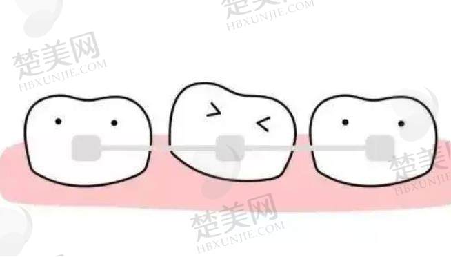 牙齿矫正dm11.jpg