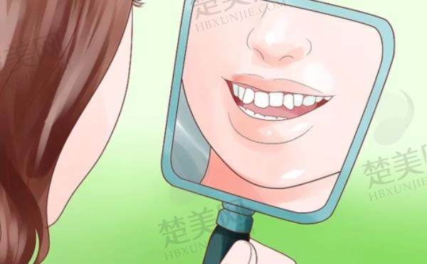 牙齿矫正dm12.jpg