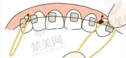九医院上海牙齿整形技术可靠吗?案例分享告诉你真相!